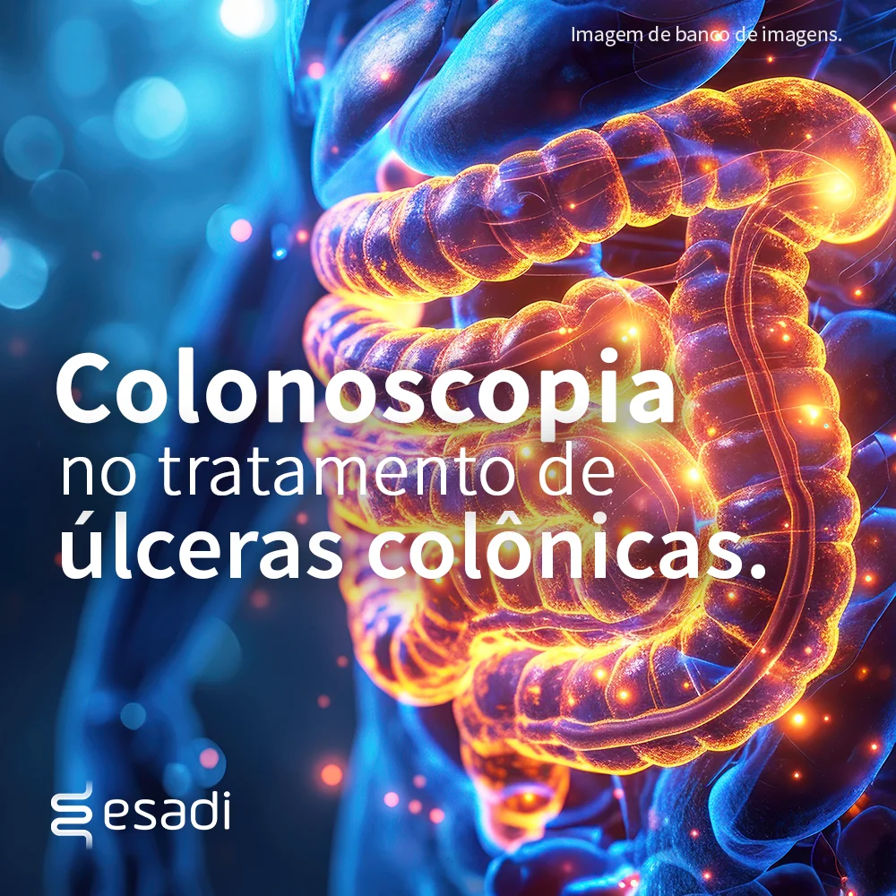 Colonoscopia no tratamento de úlceras colônicas
